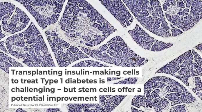 The islets of Langerhans play a crucial role in blood sugar regulation. Fayette A Reynolds/Berkshire Community College Bioscience Image Library via Flickr